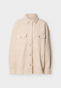 ONLTIGGY SHACKET Media 1