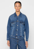 ONLKONA OVERSIZED Media 1