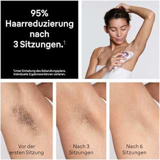 IPL-Gerät, Skin i-expert Pro IPL PL7321 Braun
