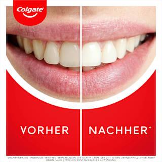 Zahnpasta Max White Ultra Freshness Pearls Colgate