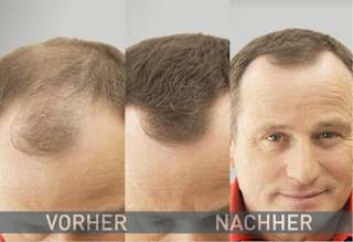 Streuhaar Haarverdichter Mittelbraun Cover Hair