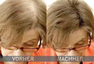 Streuhaar Haarverdichter Mittelbraun Cover Hair