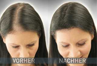 Streuhaar Haarverdichter Schwarz Cover Hair