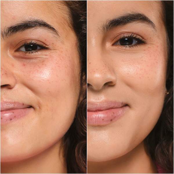 Foundation Skin Tint Hydrating Natural Finish LSF 30, 20 essence