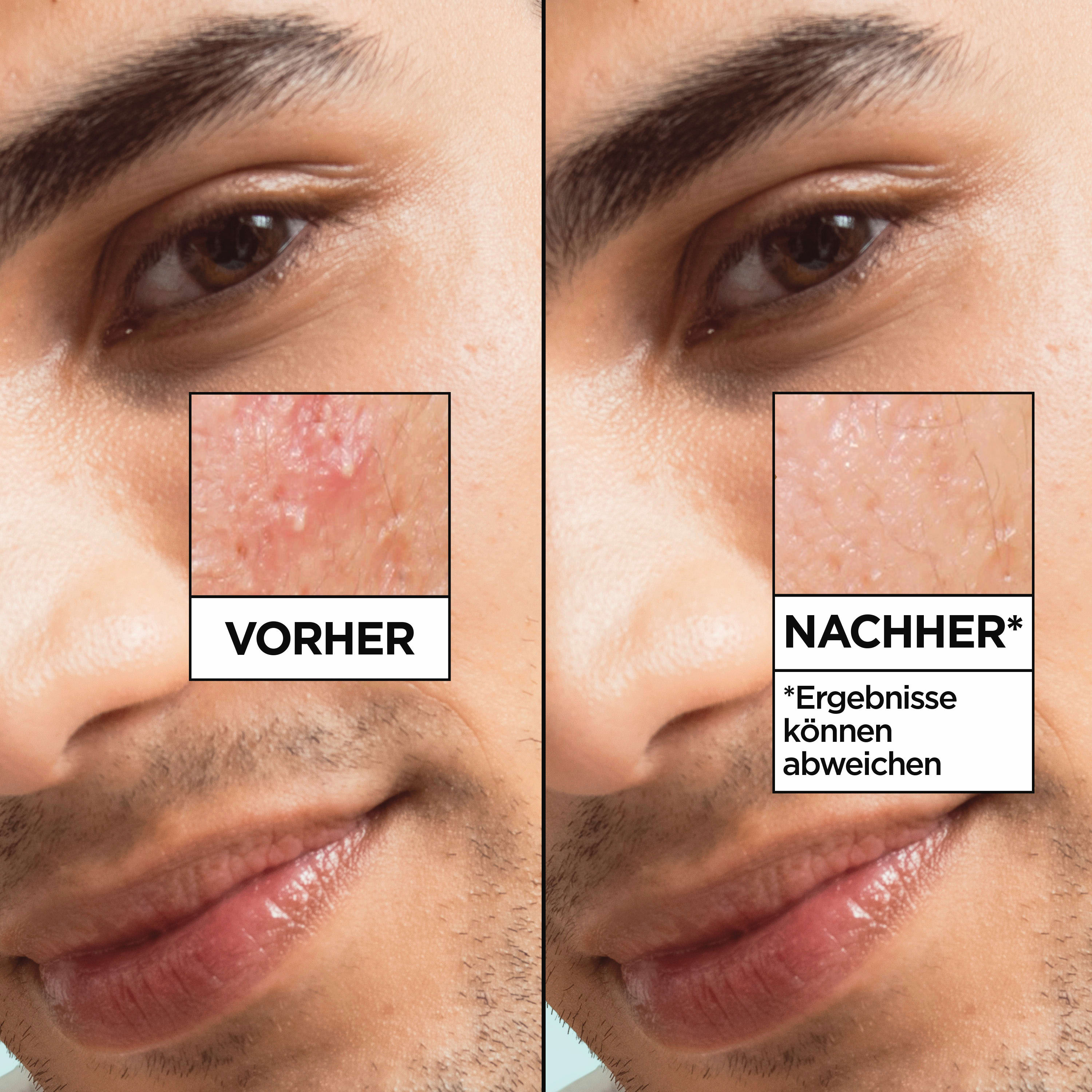 GARNIER None Media 5