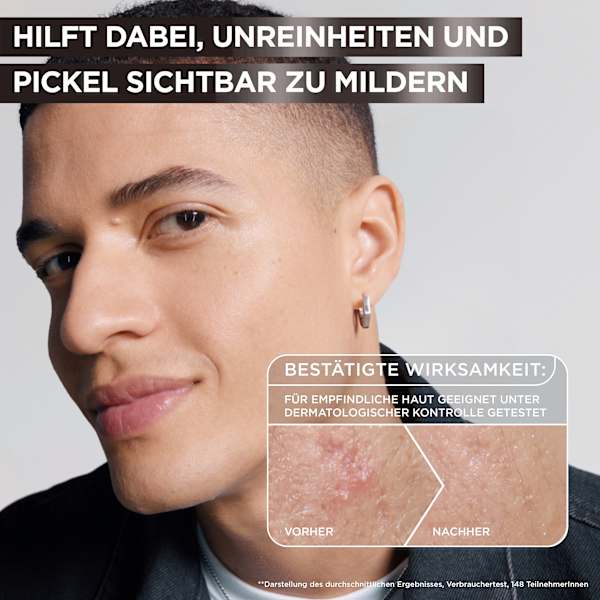 Serum Anti-Unreinheiten AHA + BHA Kohle Garnier Skin Active