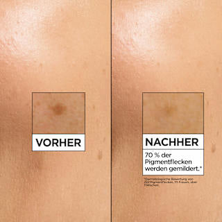 Serum Glow Booster, Vitamin C Anti-Dunkle-Flecken Garnier Skin Active