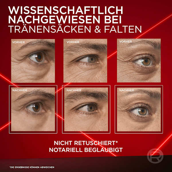 Augencreme Anti-Tränensack Laser Sofort Augenlifting L'ORÉAL PARiS