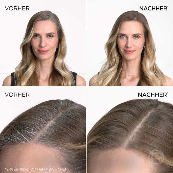 Ansatzspray Blond bis Mittelblond L'ORÉAL PARiS MAGIC RETOUCH