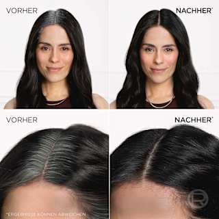 Ansatzspray Goldbraun L'ORÉAL PARiS MAGIC RETOUCH