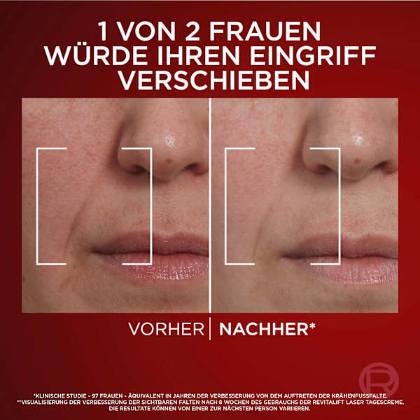 Anti Age Nachtcreme Revitalift Laser X3 L'ORÉAL PARiS REVITALIFT