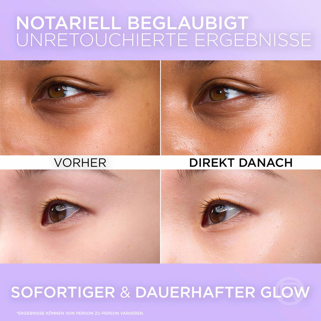 L'ORÉAL PARiS REVITALIFT None Media 3