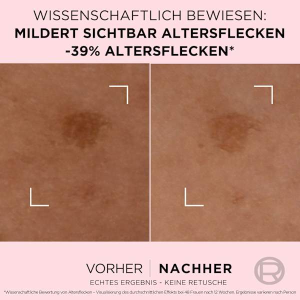 Serum Age Perfect Anti Altersflecken L'ORÉAL PARiS