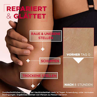 Pflegecreme 10% Urea Cica Repair Mixa