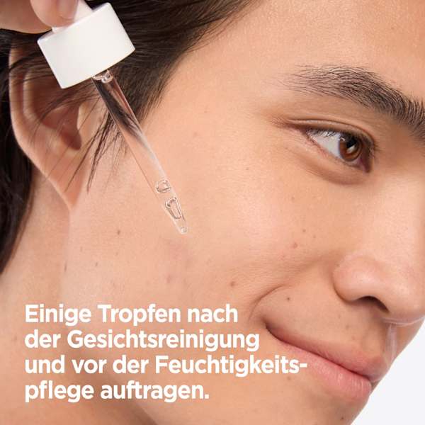 Serum Anti-Unreinheiten, Niacinamide Mixa