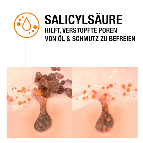 Anti Pickel Gel SOS Soforthilfe  Neutrogena