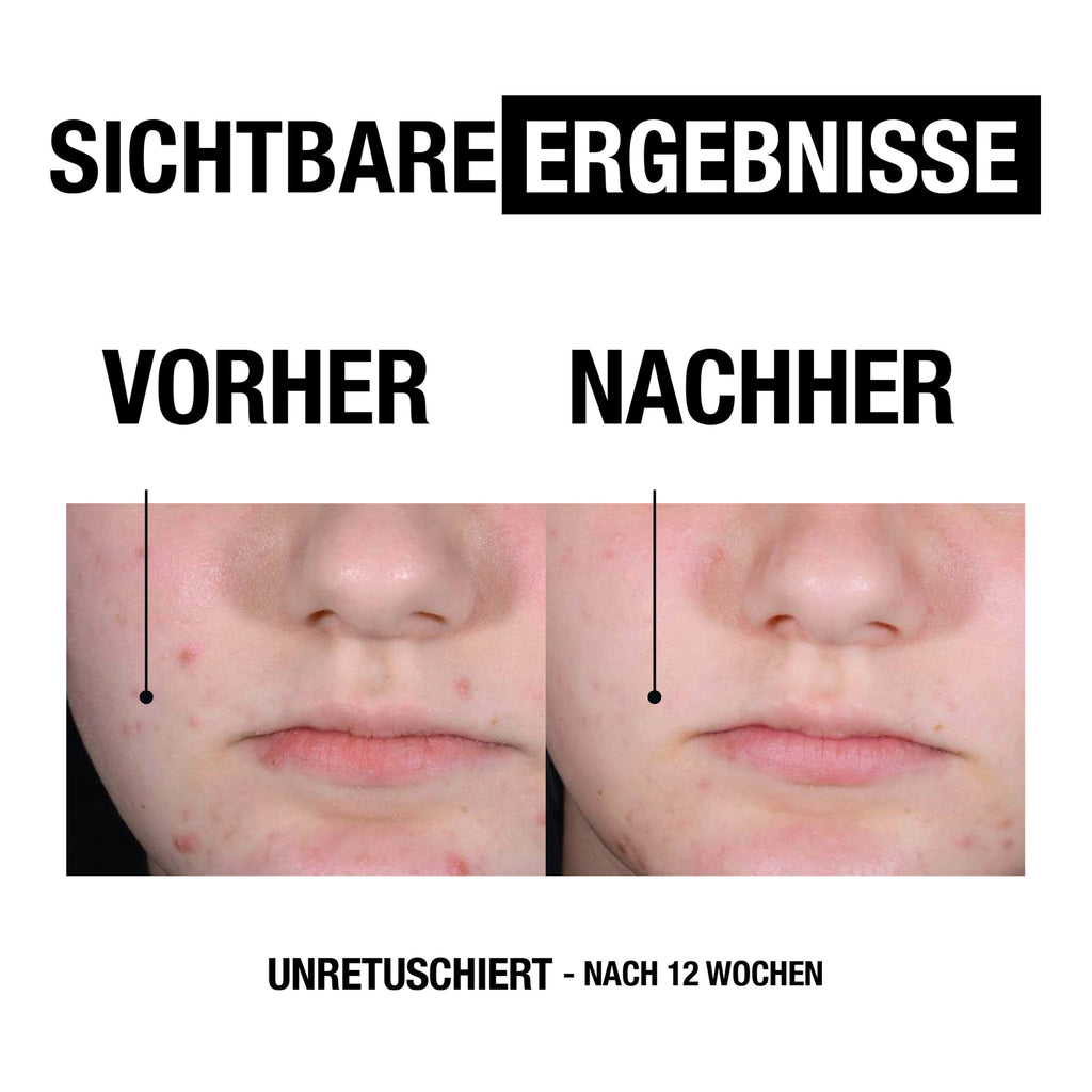 Neutrogena None Media 5