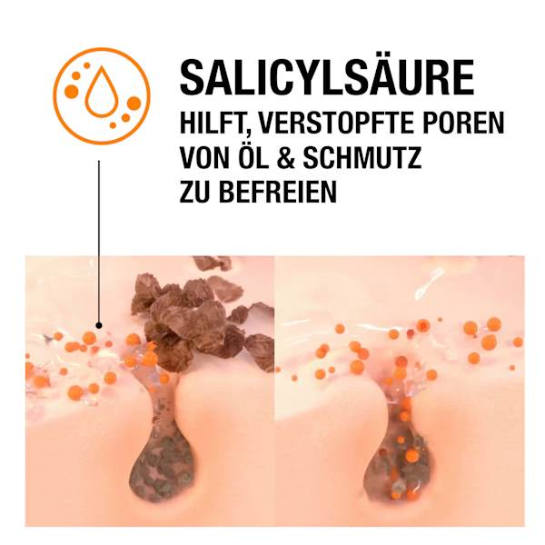 Anti Pickel Peeling Neutrogena
