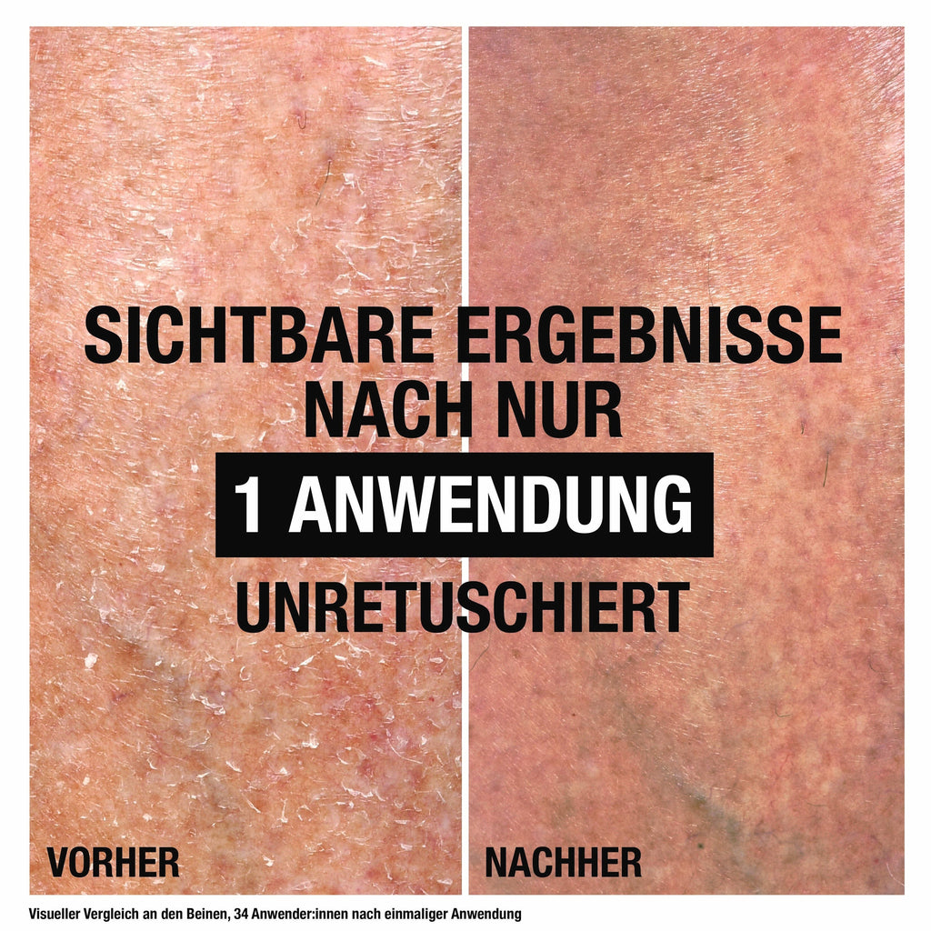 Neutrogena None Media 7