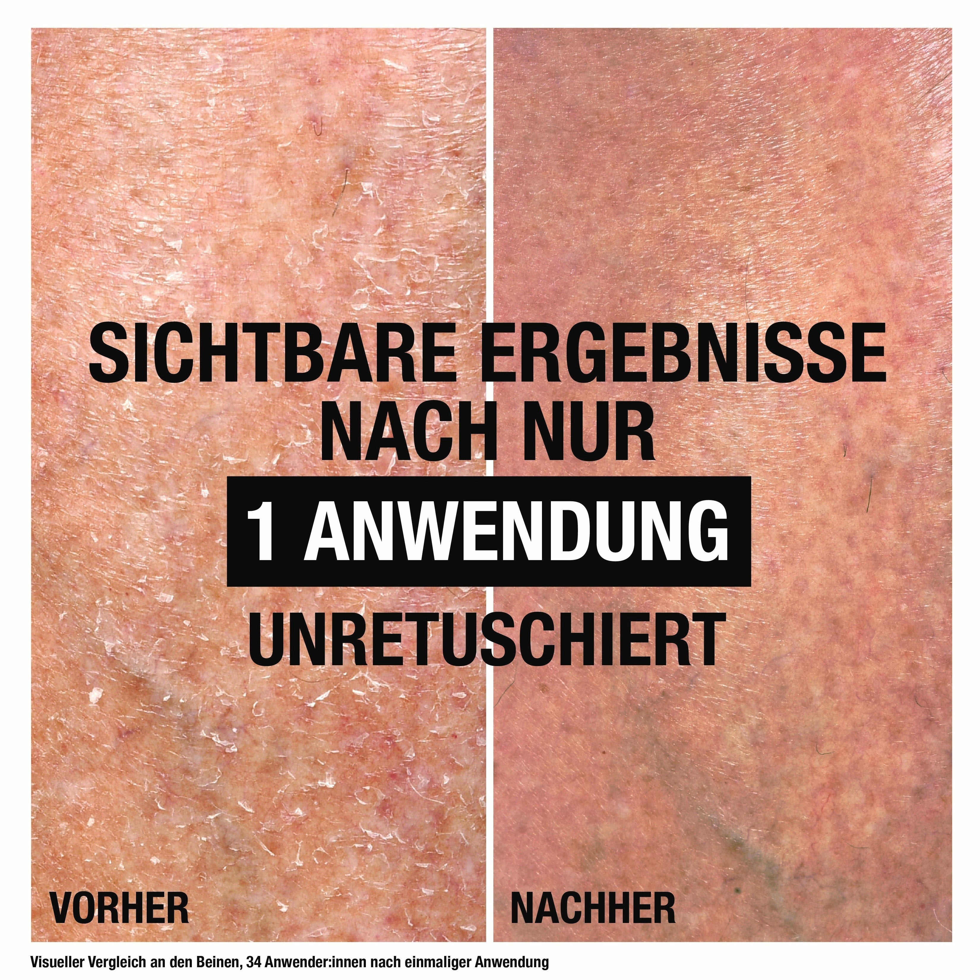 Neutrogena None Media 7