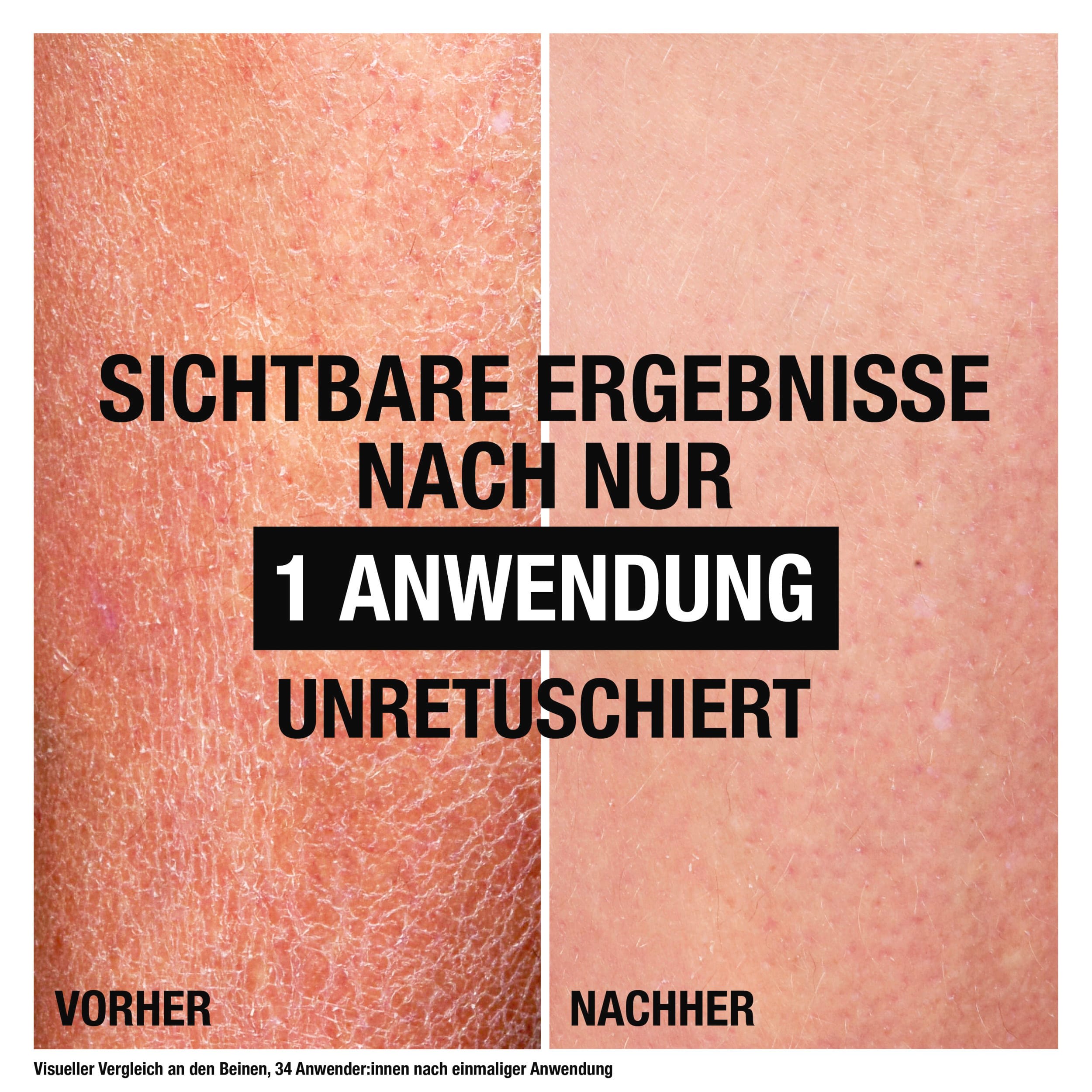 Neutrogena None Media 7