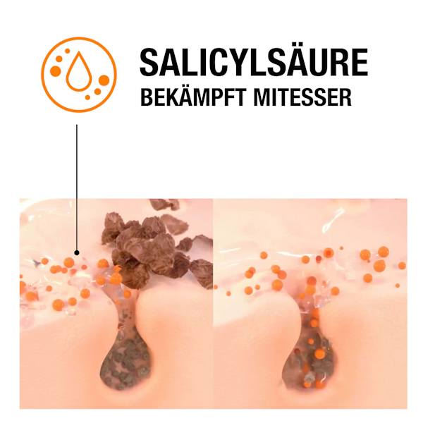Gesichtswasser Anti-Mitesser Neutrogena