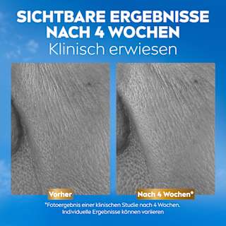 Serum Q10 Anti Falten Kollagen Experte 3in1 regenerierend NIVEA
