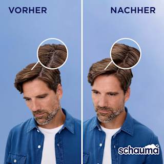 Shampoo Anti-Schuppen Classic schauma