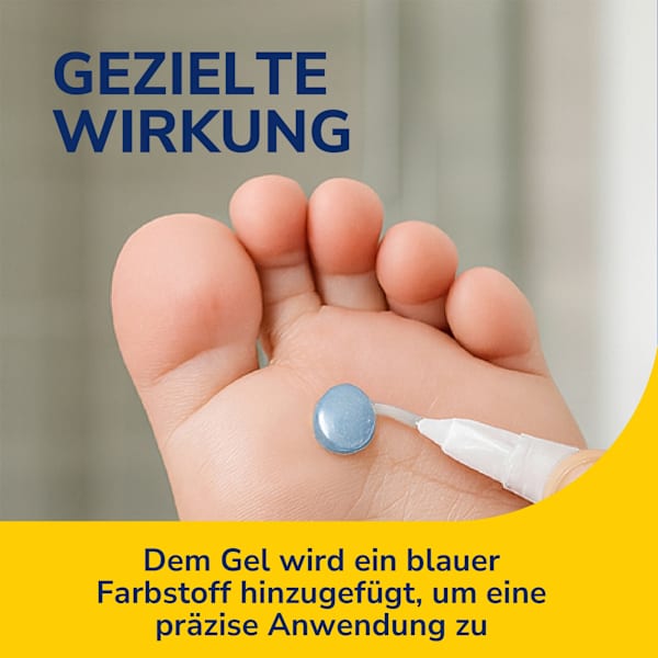 Warzen Entferner Behandlungsstift Scholl