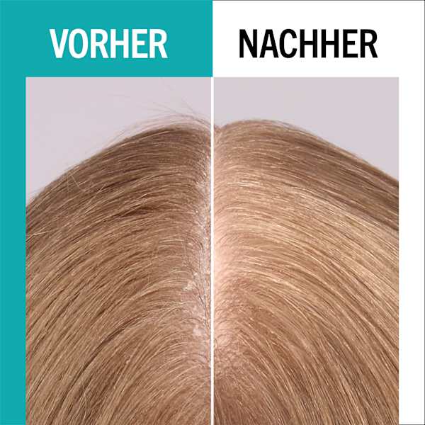 Haarserum scalp balance, feuchtigkeitsspendend Schwarzkopf GLISS