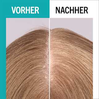 UV-Schutz Spray scalp balance LSF 20 Schwarzkopf GLISS