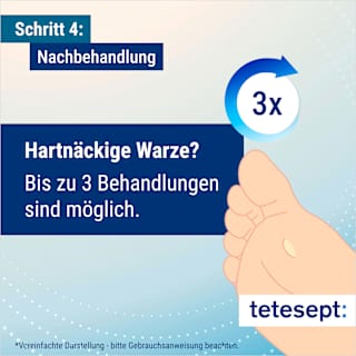 Warzen Vereiser tetesept