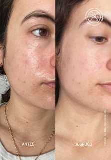 Gesichtscreme Barrier Restoring Hydrating Transparent Lab