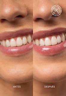 Lipgloss Clear LSF 50, regenerierend Transparent Lab
